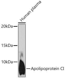ABclonal Technology&nbsp;Apolipoprotein CI Rabbit mAb