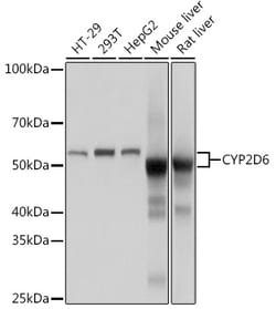 ABclonal Technology&nbsp;CYP2D6 Rabbit mAb