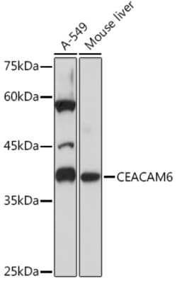 ABclonal Technology&nbsp;CEACAM6 Rabbit mAb