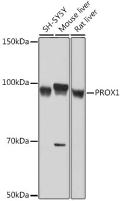 ABclonal Technology&nbsp;PROX1 Rabbit mAb