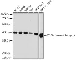 ABclonal Technology&nbsp;67kDa Laminin Receptor Rabbit mAb