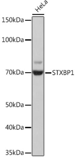 ABclonal Technology&nbsp;STXBP1 Rabbit mAb