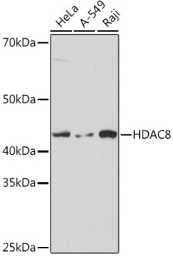ABclonal Technology&nbsp;[KO Validated] HDAC8 Rabbit mAb