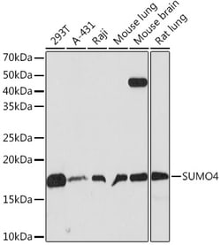 ABclonal Technology&nbsp;SUMO4 Rabbit mAb