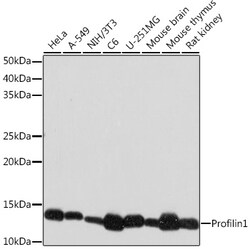 ABclonal Technology&nbsp;Profilin1 Rabbit mAb