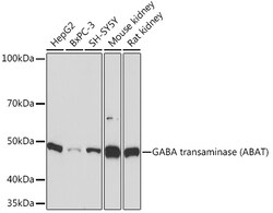 ABclonal Technology&nbsp;GABA transaminase (ABAT) Rabbit mAb