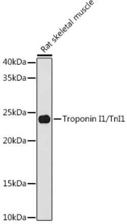 ABclonal Technology&nbsp;Troponin I1/TnI1 Rabbit mAb