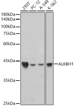 ABclonal Technology&nbsp;ALKBH1 Rabbit mAb