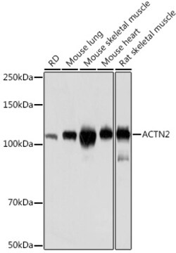 ABclonal Technology&nbsp;ACTN2 Rabbit mAb