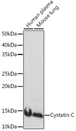 ABclonal Technology&nbsp;Cystatin C Rabbit mAb