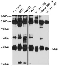 ABclonal Technology&nbsp;STX8 Rabbit pAb