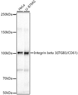 ABclonal Technology&nbsp;Integrin beta 3 (ITGB3/CD61) Rabbit pAb