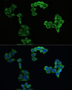 ABclonal Technology&nbsp;APP Rabbit pAb