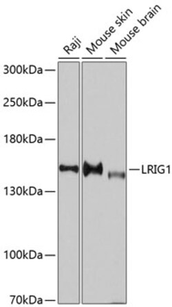 ABclonal Technology&nbsp;LRIG1 Rabbit pAb