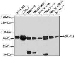 ABclonal Technology&nbsp;ADAM19 Rabbit pAb