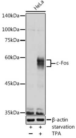 ABclonal Technology&nbsp;c-Fos Rabbit pAb