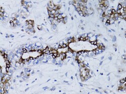 ABclonal Technology&nbsp;BRCA1 Rabbit pAb