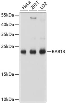 ABclonal Technology&nbsp;RAB13 Rabbit pAb
