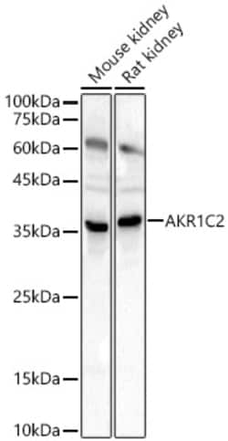 ABclonal Technology&nbsp;AKR1C2 Rabbit pAb