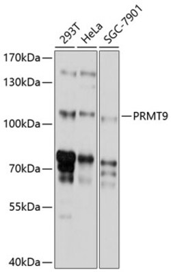 ABclonal Technology&nbsp;PRMT9 Rabbit pAb
