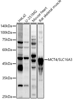 ABclonal Technology&nbsp;MCT4/SLC16A3 Rabbit pAb