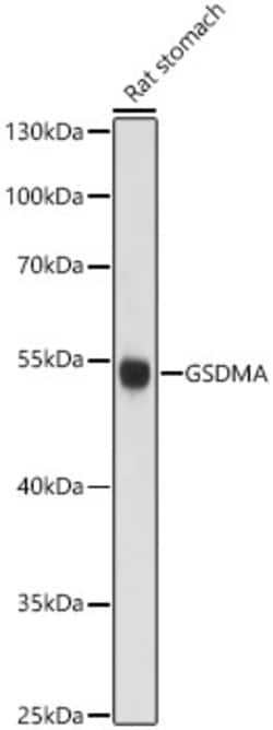 ABclonal Technology&nbsp;Gsdma Rabbit pAb
