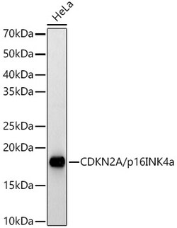 ABclonal Technology&nbsp;[KO Validated] CDKN2A/p16INK4a Rabbit pAb