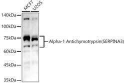 ABclonal Technology&nbsp;Alpha-1 Antichymotrypsin (SERPINA3) Rabbit pAb