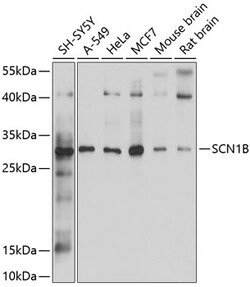 ABclonal Technology&nbsp;SCN1B Rabbit pAb