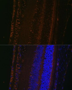 ABclonal Technology&nbsp;LOXL1 Rabbit pAb
