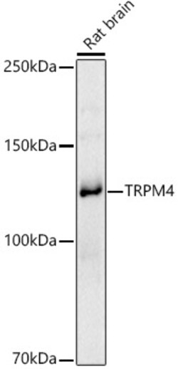 ABclonal Technology&nbsp;TRPM4 Rabbit pAb