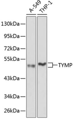 ABclonal Technology&nbsp;TYMP Rabbit pAb