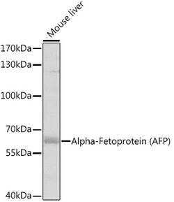 ABclonal Technology&nbsp;Alpha-Fetoprotein (AFP) Rabbit pAb