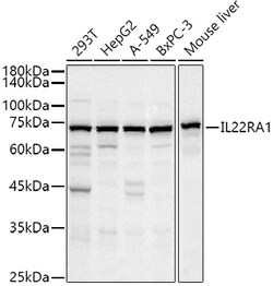 ABclonal Technology&nbsp;IL22RA1 Rabbit pAb