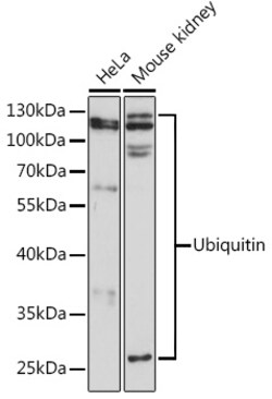 ABclonal Technology&nbsp;Ubiquitin Rabbit pAb