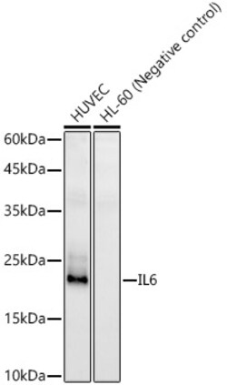ABclonal Technology&nbsp;IL6 Rabbit pAb