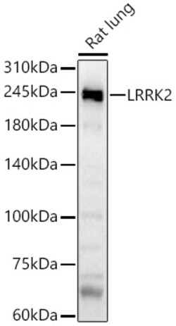 ABclonal Technology&nbsp;LRRK2 Rabbit pAb