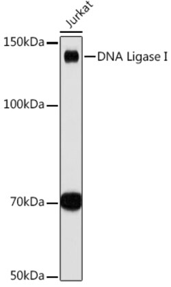 ABclonal Technology&nbsp;DNA Ligase I Rabbit mAb