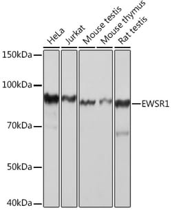 ABclonal Technology&nbsp;EWSR1 Rabbit mAb