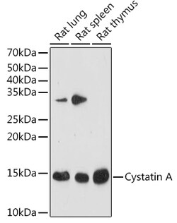 ABclonal Technology&nbsp;Cystatin A Rabbit mAb