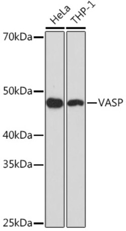 VASP Rabbit mAb