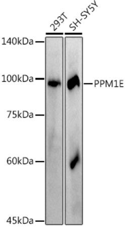 ABclonal Technology&nbsp;PPM1E Rabbit mAb