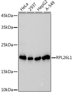 ABclonal Technology&nbsp;RPL26L1 Rabbit mAb