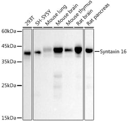 ABclonal Technology&nbsp;Syntaxin 16 Rabbit mAb