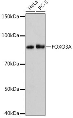 ABclonal Technology&nbsp;FOXO3A Rabbit mAb