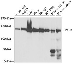 ABclonal Technology&nbsp;PKN1 Rabbit pAb