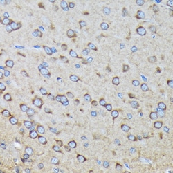 ABclonal Technology&nbsp;RALBP1 Rabbit mAb