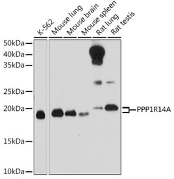 ABclonal Technology&nbsp;PPP1R14A Rabbit pAb