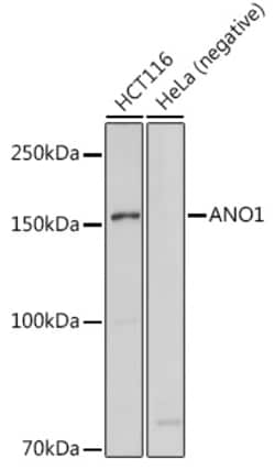 ABclonal Technology&nbsp;ANO1 Rabbit pAb