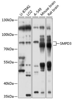 ABclonal Technology&nbsp;SMPD3 Rabbit pAb